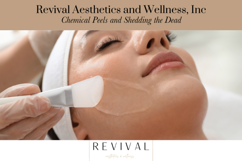 Revival Aesthetics and Wellness, Inc Chemical Peels and Shedding the Dead